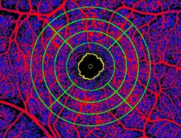 Glaucomatous Macular Vasculature: A Quantitative Analysis